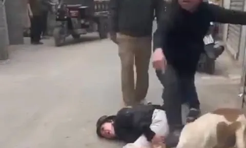 Xác minh thông tin thả chó cắn vào mặt người phụ nữ đi đường