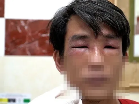 Kiến ba khoang tấn công người ở TP.HCM